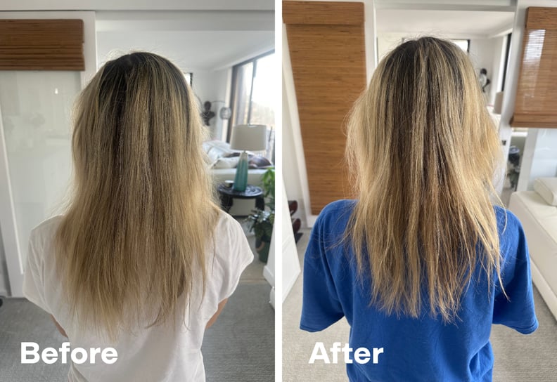 Hair growth before and after using Higherdose Red Light Hat